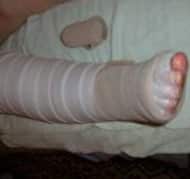 bandaging-image